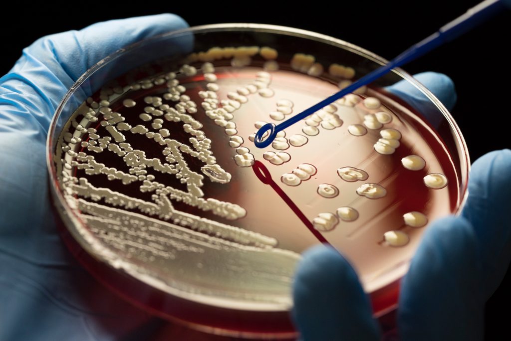 antibiotikaresistens i spildevandsprøver Derfor virker antibiotika snart ikke længere – og hvad det betyder for dig